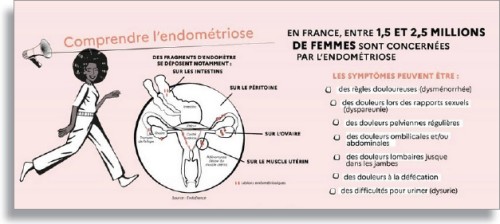 Infographie sur l'endométriose